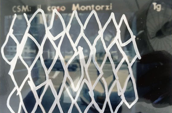 Mario Schifano - CSM, il caso Mantozzi